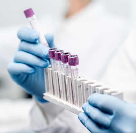 Image of a scientist placing test tubes into a rack